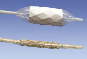 Mounted-CPStent-300×203-1
