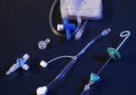 ascites-1-300×450-1