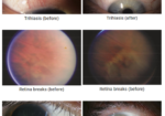 OPHTHALMOLOGY – CRYO-S Electric