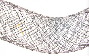 EGIS Pyloric Stent