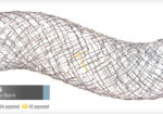 EGIS Pyloric Stent