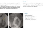 EGIS Pyloric Stent