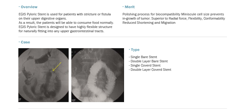 EGIS Pyloric Stent