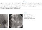 EGIS Colorectal Stent