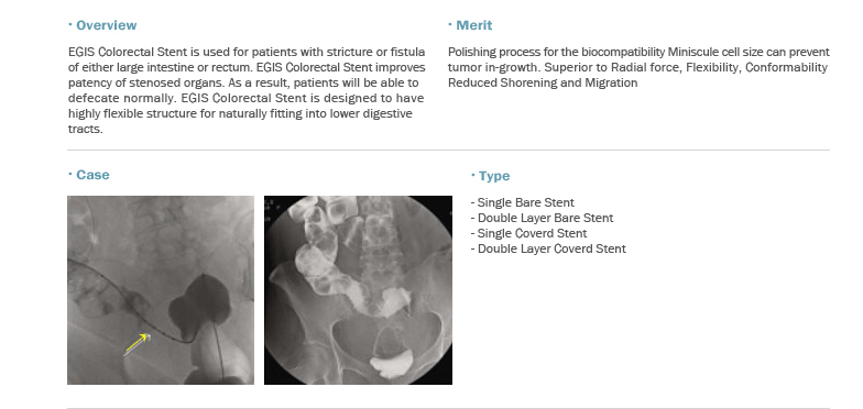 EGIS Colorectal Stent