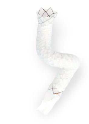 EGIS Biliary Flared Fully Covered Valve Stent