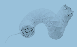 Fully-covered-300×186-1